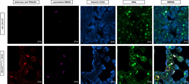 Figure 5: Nanoparticle uptake in cells